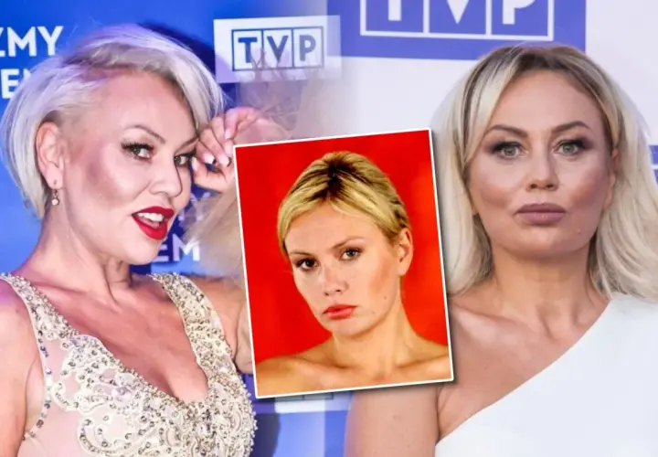 Monika Jarosińska w porównaniu do zdjęć z przeszłości, gdzie widać jej męża, prezentuje się po operacjach plastycznych.