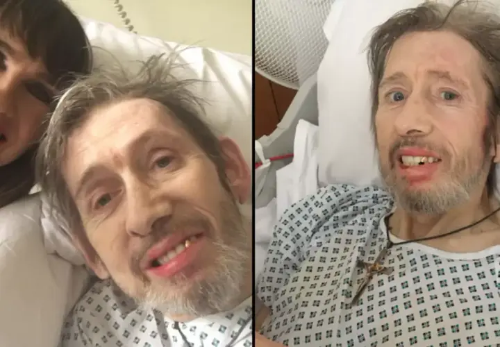 Czy Shane MacGowan opuścił już szpital? Dowiedz się najnowszych informacji!